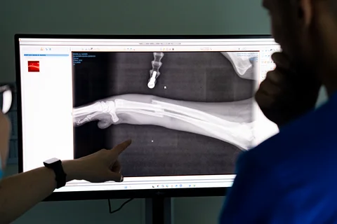 جراحة العظام في مركز بارك فيو الدوحة